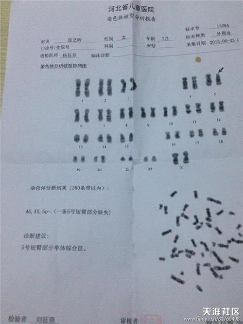借卵做试管代怀的好价格