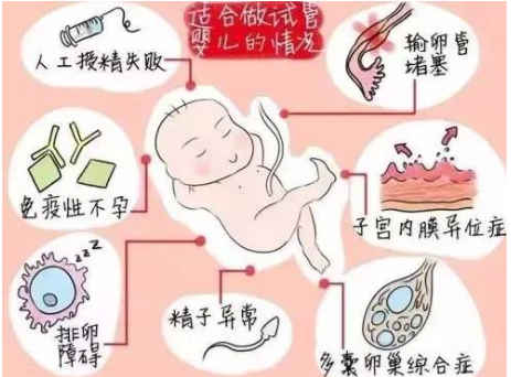 女性47岁还能不能做供卵代生机构附女性47岁供卵试管自怀成功率影响因素介绍
