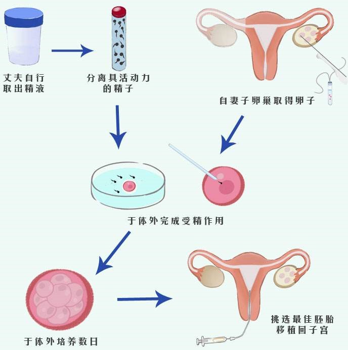 私立借卵试管医院单身女可以做吗