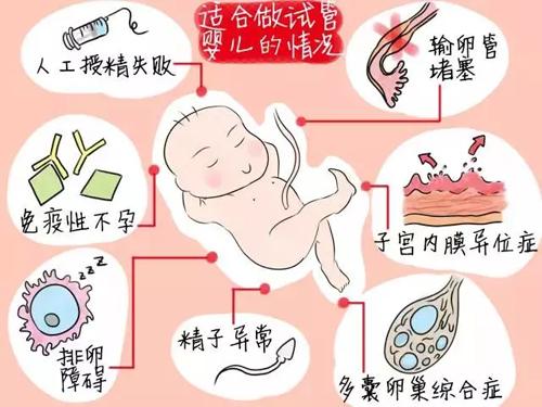借卵试管后为啥宫外孕