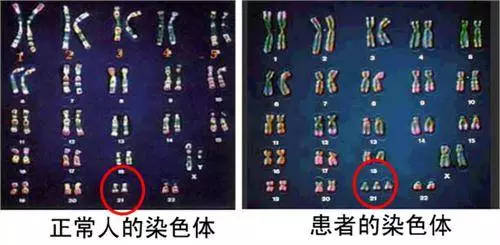 北京市市借卵做试管婴儿医保报销吗