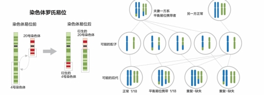 山大生殖做试管费用多少钱