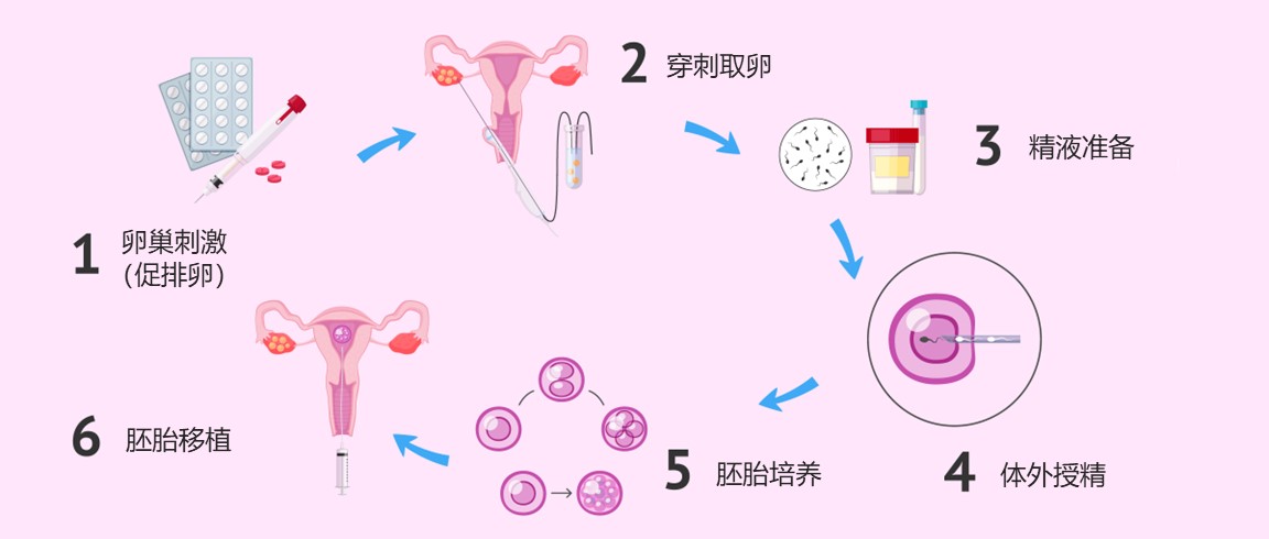 试管婴儿拮抗剂是什么药