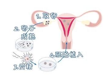 胚胎克隆是试管婴儿吗