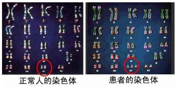 北京市中心医院做试管三代成功率怎么样？高不高？