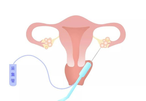 北京供精试管医院哪家好？2家供精助孕医院哪家成功率最高？