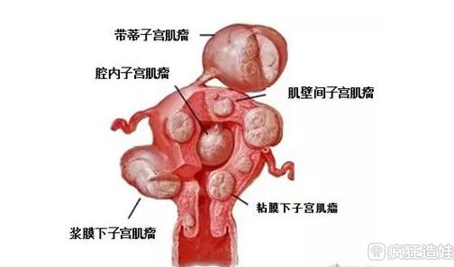 二胎政策下生二胎也可能罚款!不信看看这个案例