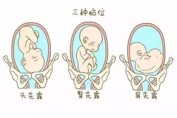 孕妇怀男孩和怀女孩的睡觉特征是不是不一样
