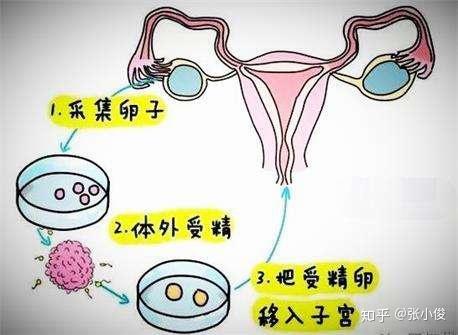 有腺肌症和腺肌瘤能做第三代借卵代生孩子全包吗（症第三代代怀双胞胎男孩可行吗？）
