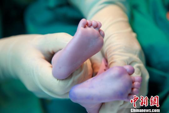 2024北京第二附属医院生殖中心哪个医生的试管助孕技术好