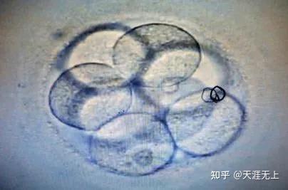 供卵代生收费大概要多少钱北京（平均44702元）