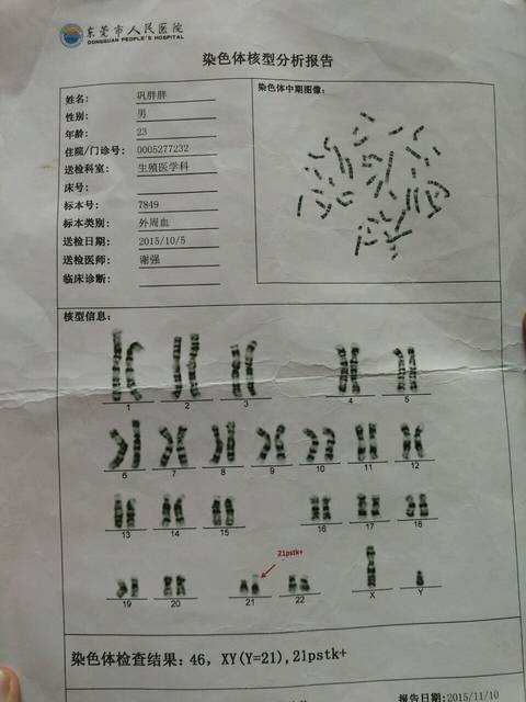 北医三院二代自然周期方案费用贵吗