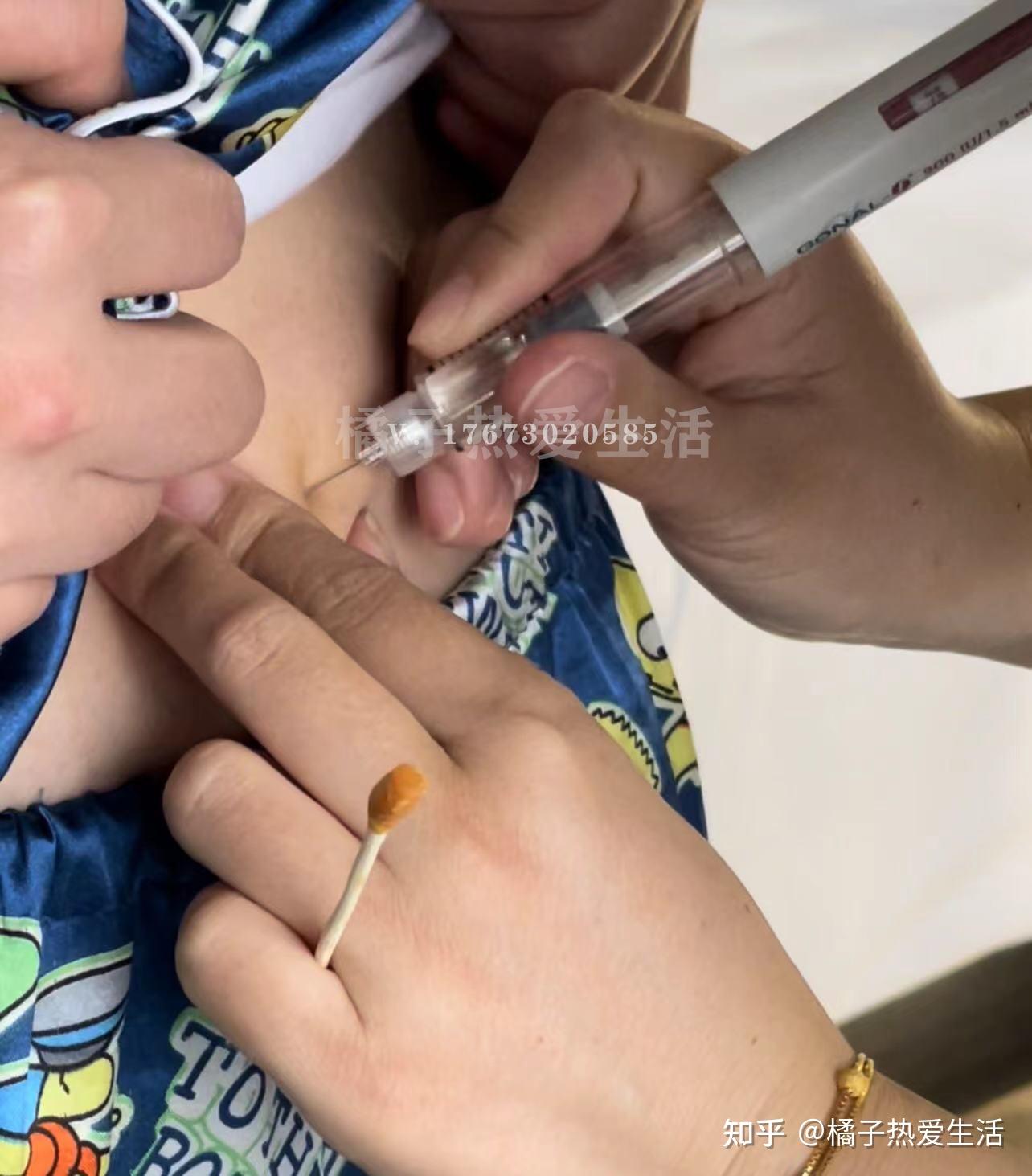 2024年北京市妇幼保健院供卵生孩子费用多少多少钱